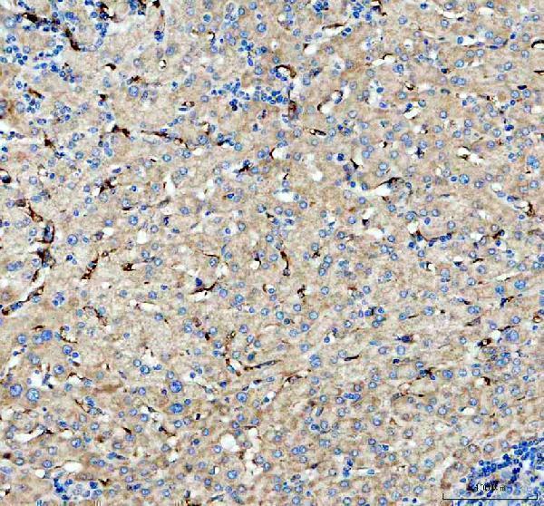 IHC analysis of CD206/MRC1 using anti-CD206/MRC1 antibody (M02285-3)