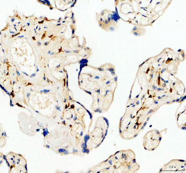 IHC analysis of CD206/MRC1 using anti-CD206/MRC1 antibody (M02285-3)