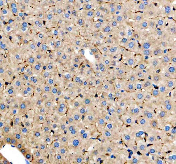 m02285 3 cd206 primary antibodies ihc testing 3