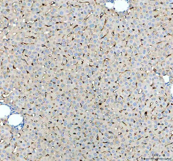 m02285 3 cd206 primary antibodies ihc testing 4