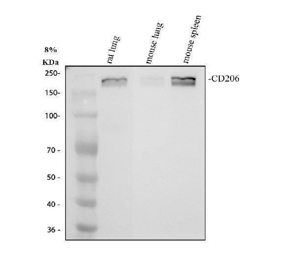 Western blot analysis of CD206/MRC1 using anti-CD206/MRC1 antibody (M02285-3)
