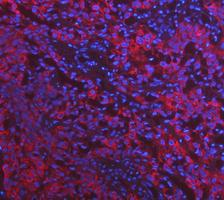 m02289 1 cytokeratin 17 primary antibodies if testing 5_1