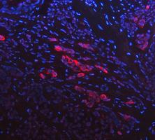 m02289 1 cytokeratin 17 primary antibodies if testing 6