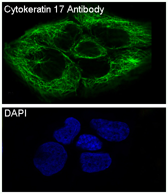 m02289 1 cytokeratin 17 primary antibodies if testing 7