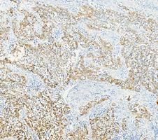 m02289 1 cytokeratin 17 primary antibodies ihc testing 2