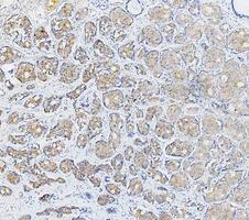 m02289 1 cytokeratin 17 primary antibodies ihc testing 3