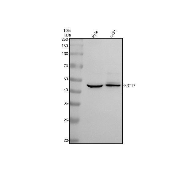 m02289 1 krt17 primary antibodies wb testing 1