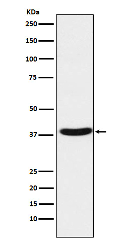 Western blot analysis of MT-ND1 expression in Human fetal muscle lysate.