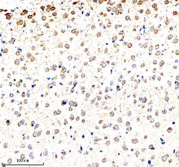  IHC analysis of UBE2I using anti-UBE2I antibody (M02295)