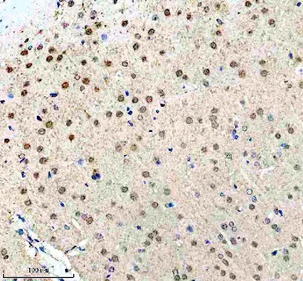 IHC analysis of UBE2I using anti-UBE2I antibody (M02295)