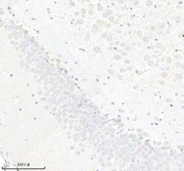 m02295 ube2i primary antibodies ihc testing 4