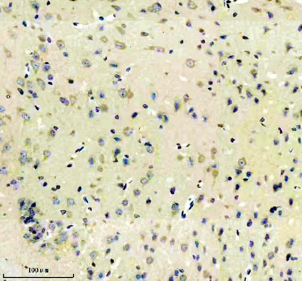 m02296 eea1 primary antibodies ihc testing 1