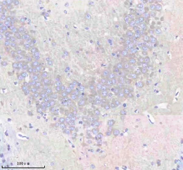m02296 eea1 primary antibodies ihc testing 2