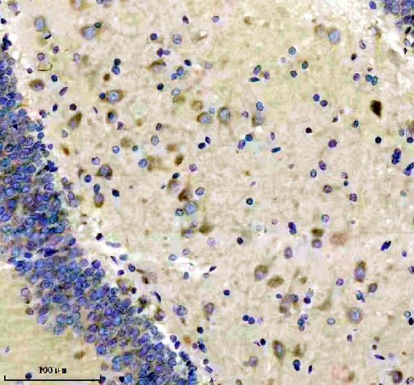 m02296 eea1 primary antibodies ihc testing 4