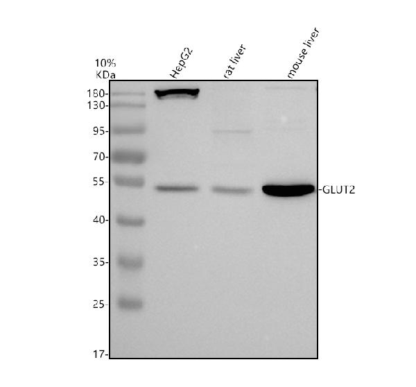 m02297 2 slc2a2 primary antibodies wb testing 1