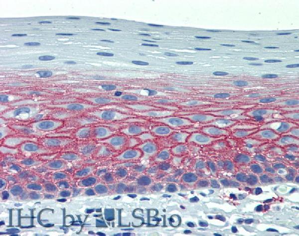 Immunohistochemistry staining of human tonsil (paraffin-embedded sections) with anti-CD82 (C33)