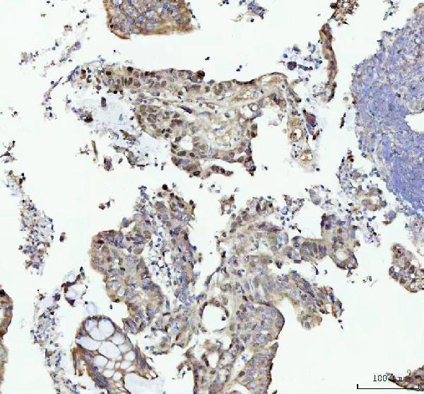 IHC analysis of MCM4 using anti-MCM4 antibody (M02301)