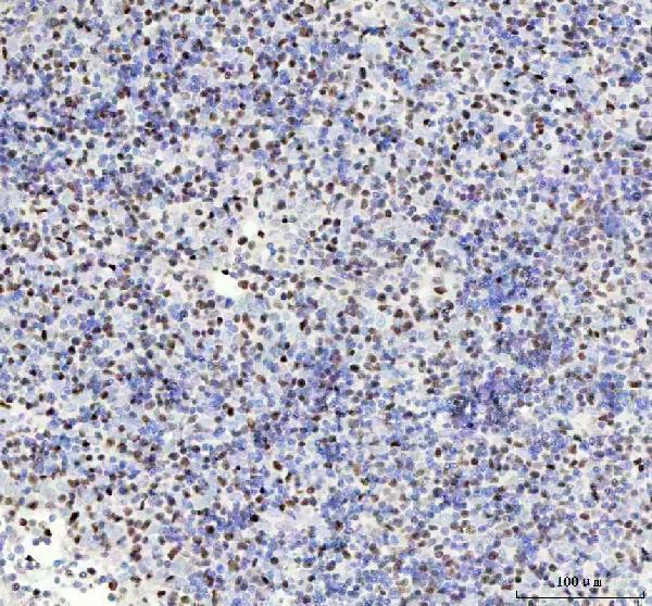  IHC analysis of MCM4 using anti-MCM4 antibody (M02301)