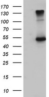 HEK293T cells were transfected with the pCMV6-ENTRY control (Left lane) or pCMV6-ENTRY EFEMP1 (Right lane) cDNA for 48 hrs and lysed