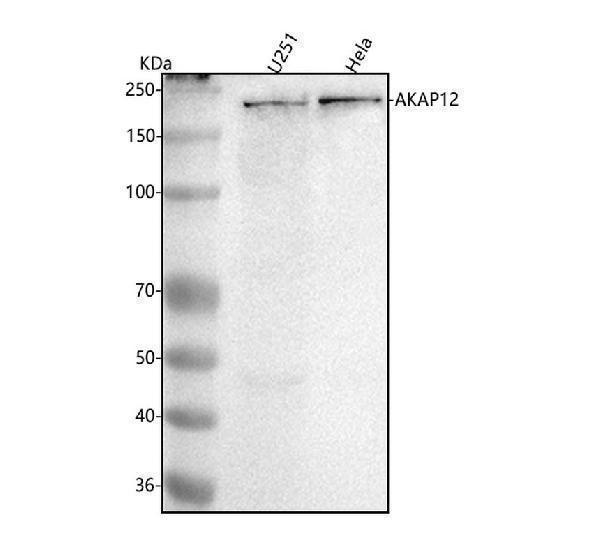  Western blot analysis of AKAP12 using anti-AKAP12 antibody (M02303)