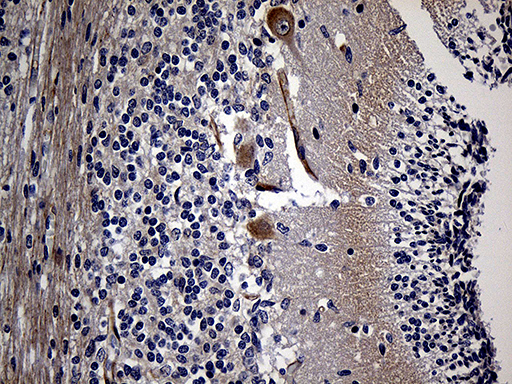 m02303 anti akap12 mouse monoclonal antibody clone id oti1b6 ihc testing 4