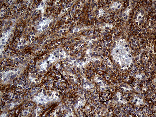 Immunohistochemical staining of paraffin-embedded Human spleen tissue within the normal limits using anti-AKAP12 mouse monoclonal antibody
