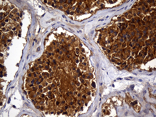 Immunohistochemical staining of paraffin-embedded Human testicle tissue within the normal limits using anti-AKAP12 mouse monoclonal antibody