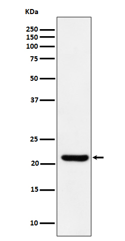 Western blot analysis of ITPA expression in HepG2 cell lysate