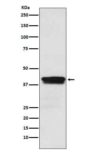 Western blot analysis of MBNL1 expression in Jurkat cell lysate