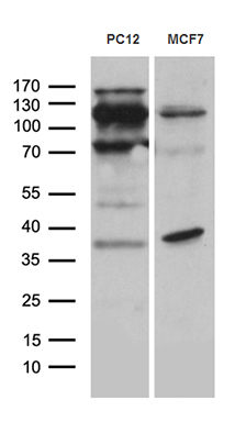 Western blot analysis of extracts (35ug) from 2 different cell lines by using anti-REV1 monoclonal antibody (1:500)