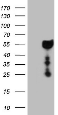 HEK293T cells were transfected with the pCMV6-ENTRY control (Left lane) or pCMV6-ENTRY DMRT1 (Right lane) cDNA for 48 hrs and lysed