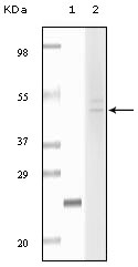 Western blotting validation for Anti-Fibulin-5 FBLN5 Monoclonal Antibody M02317
Western Blot (WB) analysis using Fibulin-5 Monoclonal Antibody against truncated fibulin5 recombinant protein (1) and HeLa cell lysate (2)