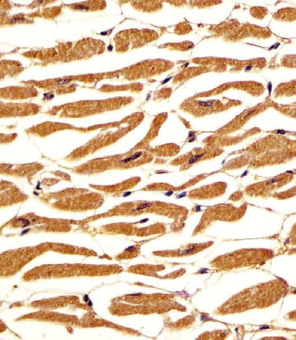 m02318 anti pgm1 antibody c term ihc p testing 4