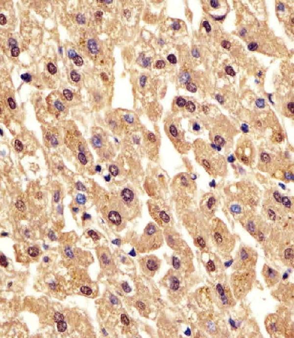 m02318 anti pgm1 antibody c term ihc p testing 5
