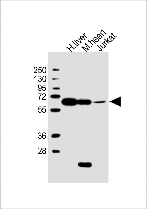 All lanes : Anti-PGM1 Antibody (C-Term) at 1:2000 dilutionLane 1: human liver lysateLane 2: mouse heart lysateLane 3: Jurkat whole cell lysateLysates/proteins at 20 µg per lane