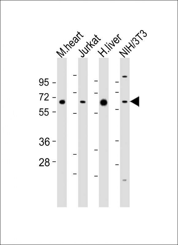 All lanes : Anti-PGM1 Antibody (C-Term) at 1:2000 dilutionLane 1: mouse heart lysatesLane 2: Jurkat whole cell lysatesLane 3: human liver lysatesLane 4: NIH/3T3 whole cell lysatesLysates/proteins at 20 µg per lane