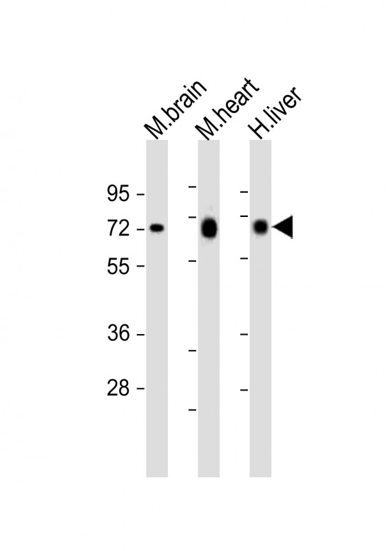 All lanes : Anti-PGM1 Antibody (C-Term) at 1:2000 dilutionLane 1: mouse brain lysatesLane 2: mouse heart lysatesLane 3: human liver lysatesLysates/proteins at 20 µg per lane