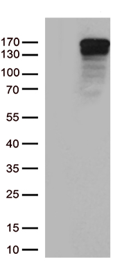 HEK293T cells were transfected with the pCMV6-ENTRY control (Left lane) or pCMV6-ENTRY TRPS1 (Right lane) cDNA for 48 hrs and lysed