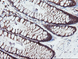 m02329 anti senp2 mouse monoclonal antibody clone id oti3e7 ihc testing 12