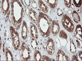 m02329 anti senp2 mouse monoclonal antibody clone id oti3e7 ihc testing 13