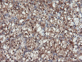 m02329 anti senp2 mouse monoclonal antibody clone id oti3e7 ihc testing 14