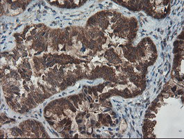 m02329 anti senp2 mouse monoclonal antibody clone id oti3e7 ihc testing 4