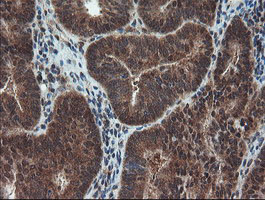 m02329 anti senp2 mouse monoclonal antibody clone id oti3e7 ihc testing 7