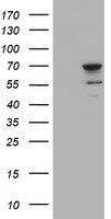 HEK293T cells were transfected with the pCMV6-ENTRY control (Left lane) or pCMV6-ENTRY SENP2 (Right lane) cDNA for 48 hrs and lysed