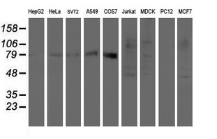Western blot analysis of extracts (35ug) from 9 different cell lines by usin g anti-SENP2 monoclonal antibody (HepG2: human; HeLa: human; SVT2: mouse; A549: human; COS7: monkey; Jurkat: human; MDCK: canine; PC12: rat; MCF7: human)