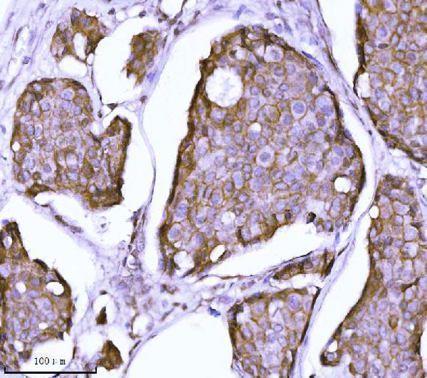  IHC analysis of CTNND1 using anti-CTNND1 antibody (M02333-2)