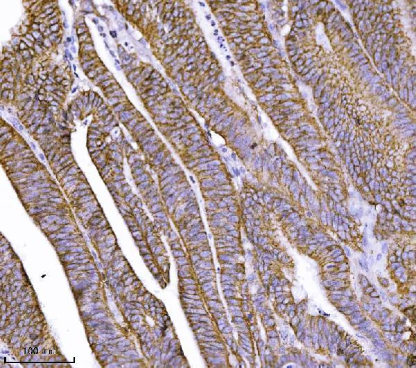  IHC analysis of CTNND1 using anti-CTNND1 antibody (M02333-2)