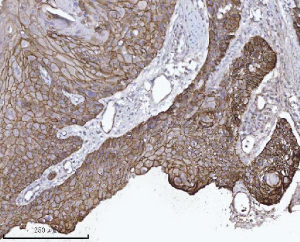 m02333 2 ctnnd1 primary antibodies ihc testing 4
