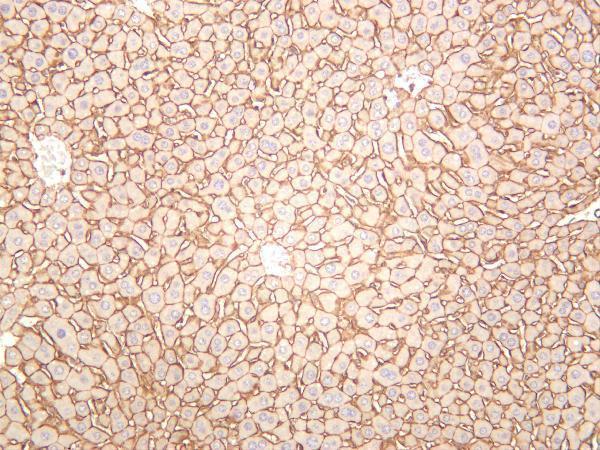 m02333 4 ctnnd1 primary antibodies ihc testing 4