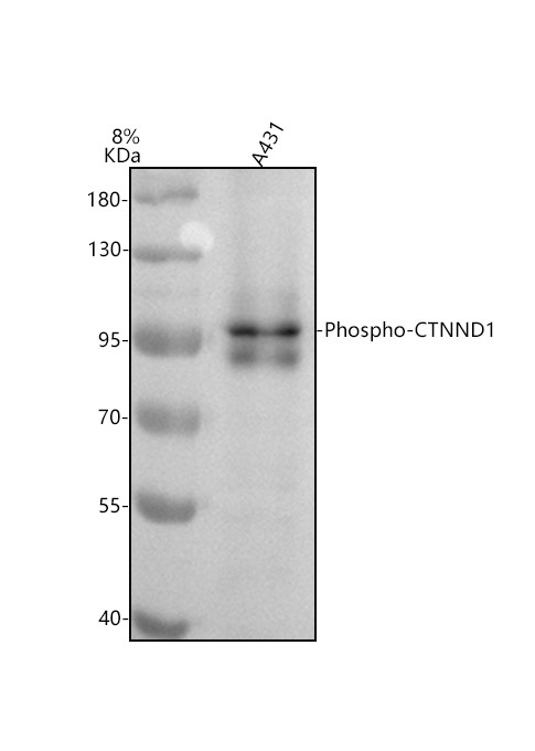 Western blot analysis of Phospho-CTNND1 using anti-Phospho-CTNND1 antibody (M02333Y228)